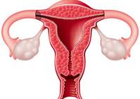 Endometriose